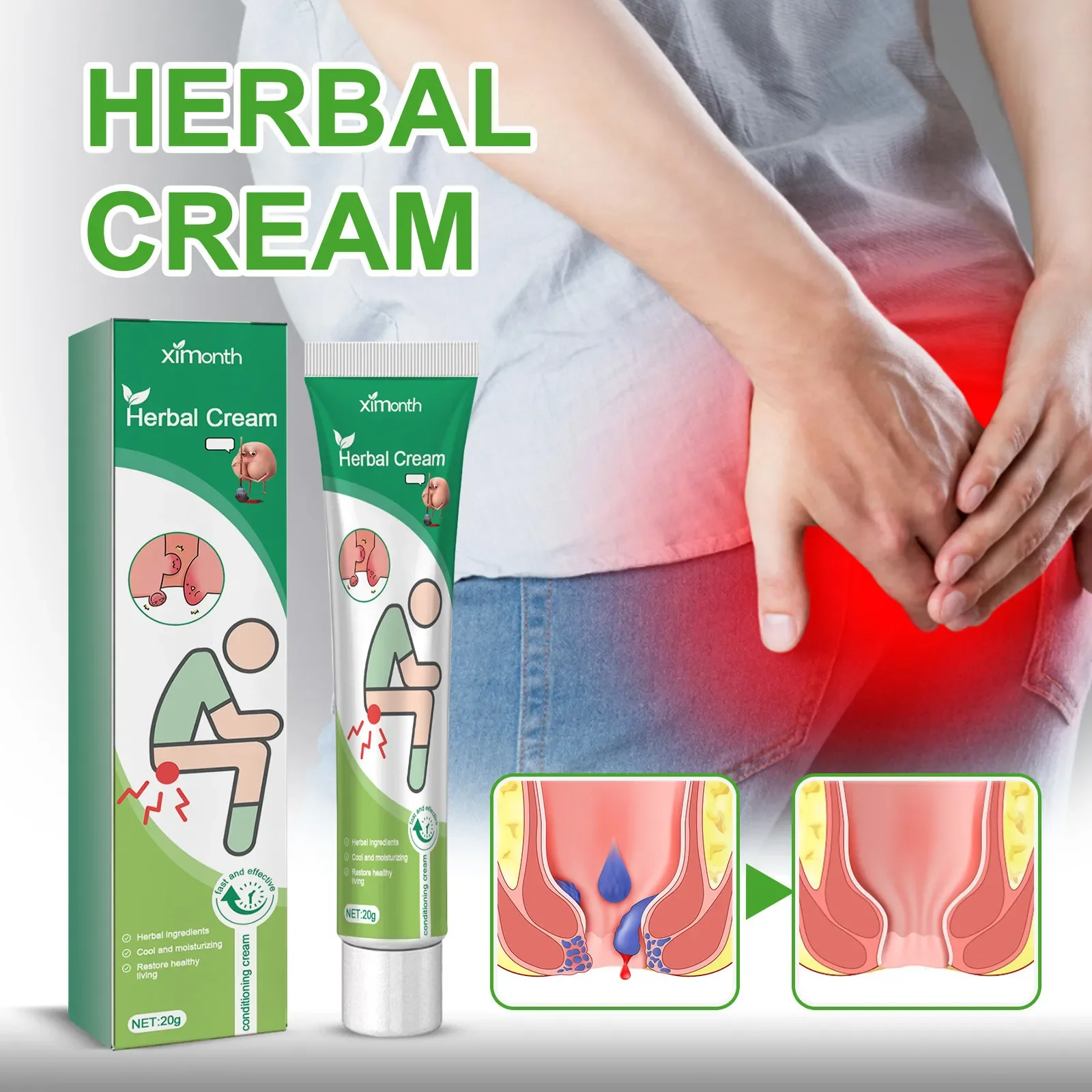 Hemorrhoid Ointment Anal Fissure Therapy Pain Relief Reduce Swell Bleed Treat Internal External Hemorrhoid Cream Health Care