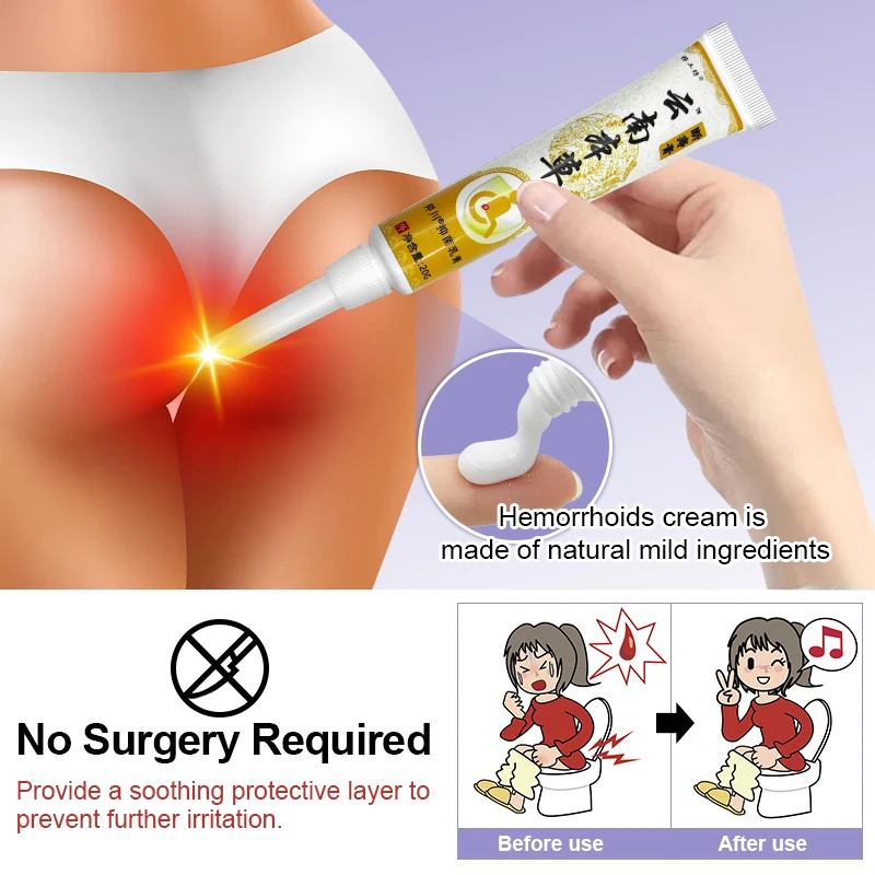 Herbal Medicine Hemorrhoids Ointment Health Care Mixed Hemorrhoids Cream Relief Anal Pain Swelling Treat Anal Fissure A1693 2Pcs