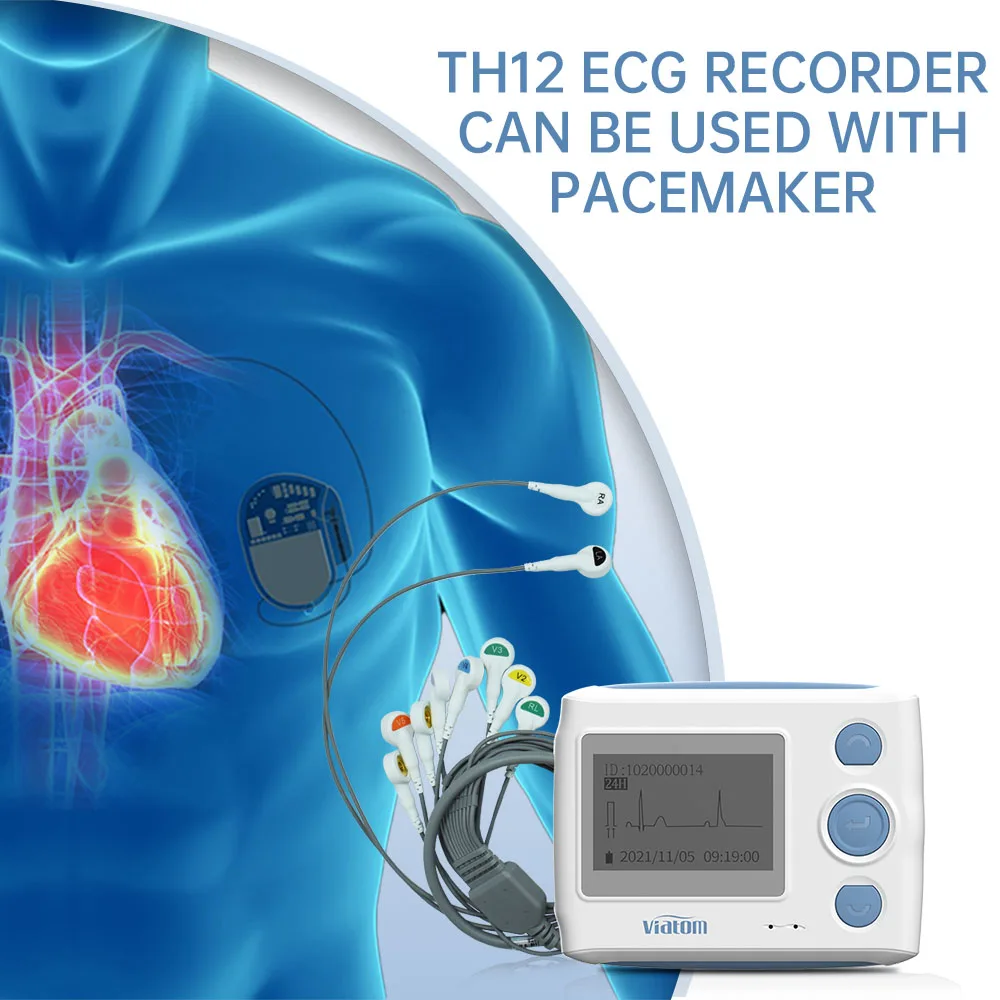 Bluetooth electrocardiogram monitor 12 lead dynamic electrocardiogram 24-hour monitoring heart data storage ma
