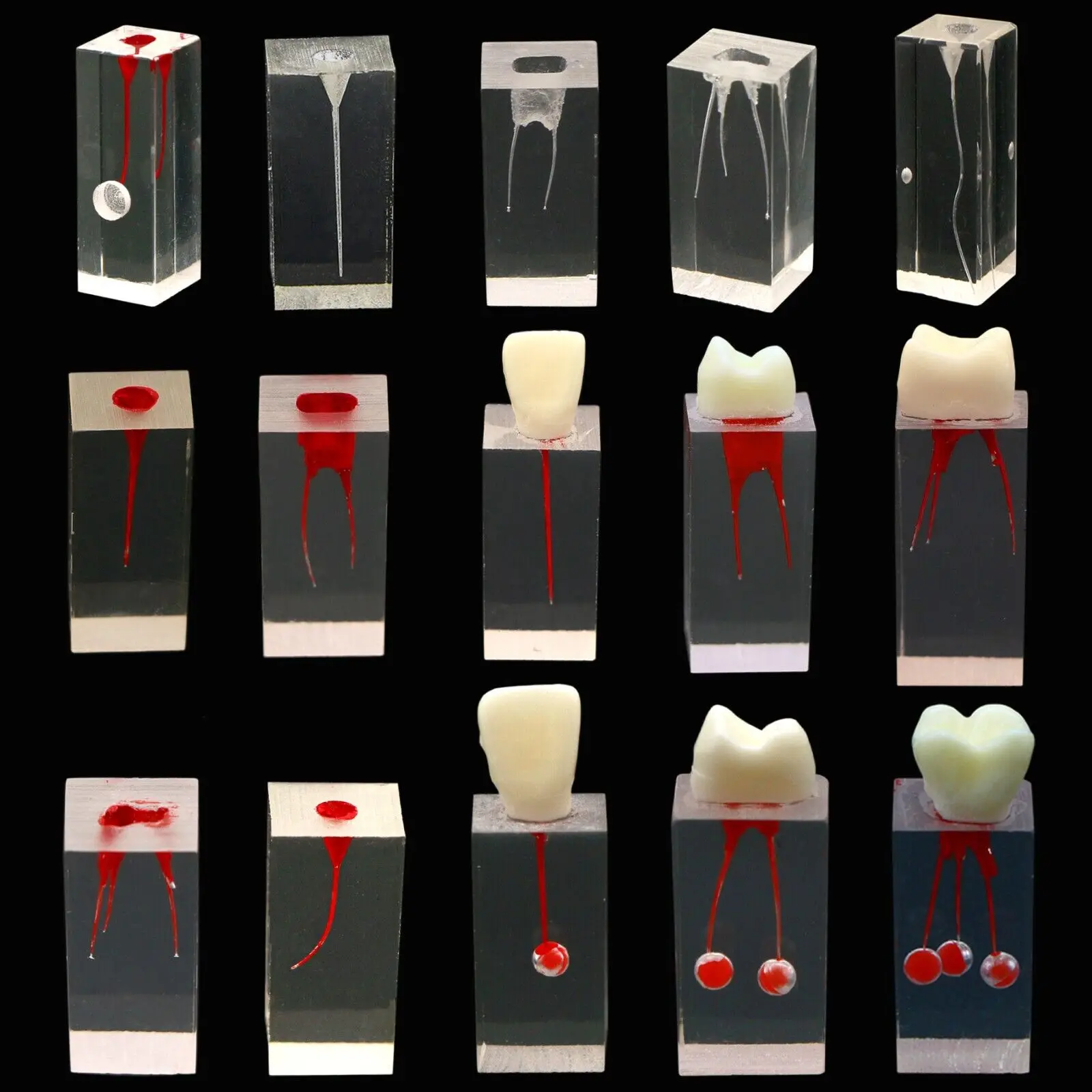 10pcs Dental Root Canal Tooth Molar Study Endodontic Rotary Files