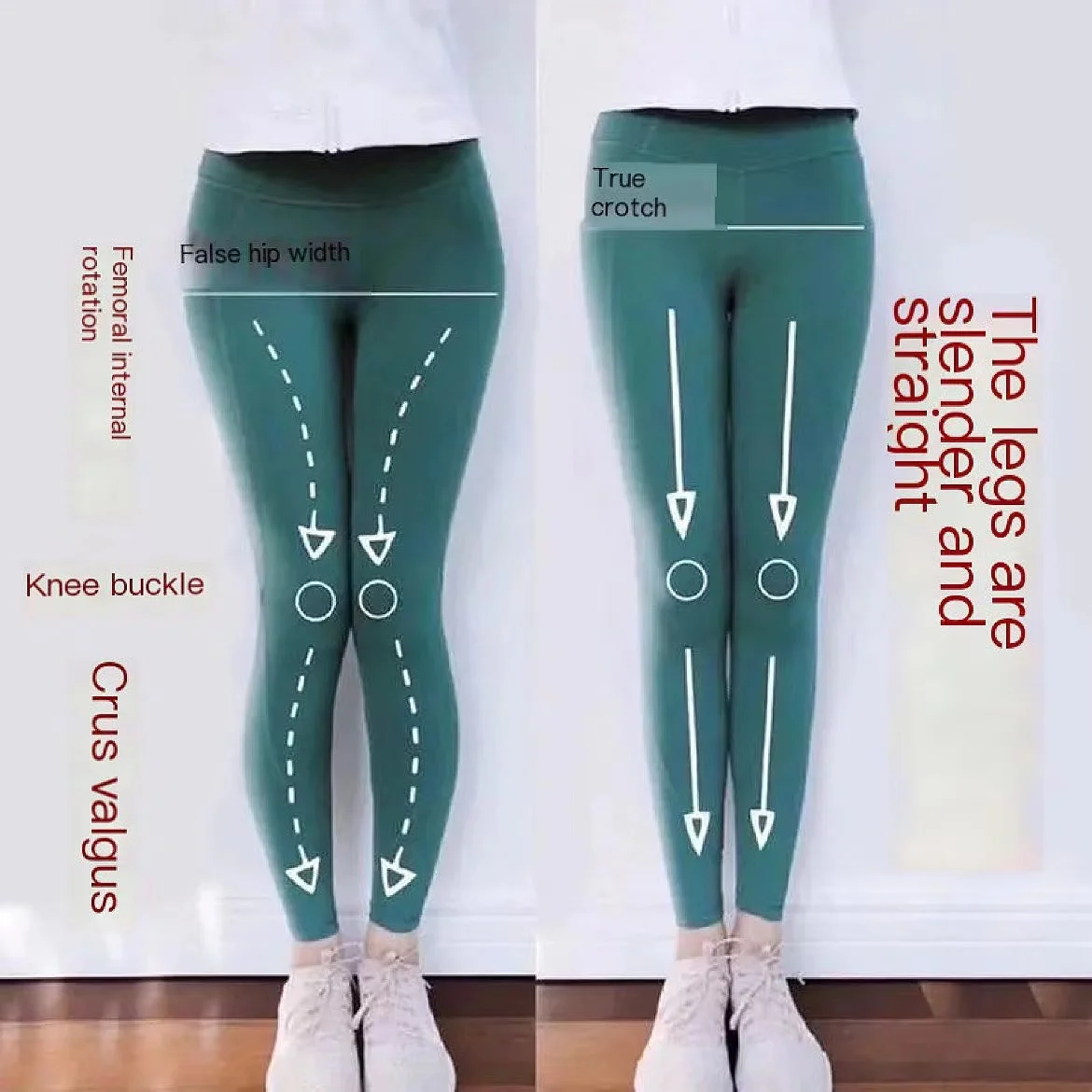 XOshapedLegCorrectionInsoleInsideEightFigureOutsideEight