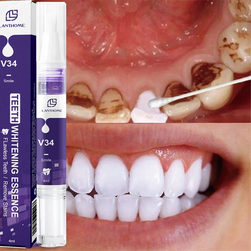 

Teeth Whitening Pen Removes Plaque Stains Essence Tooth Bleaching Cleaning Serum White Teeth Oral Hygiene Tooth Whitening Care