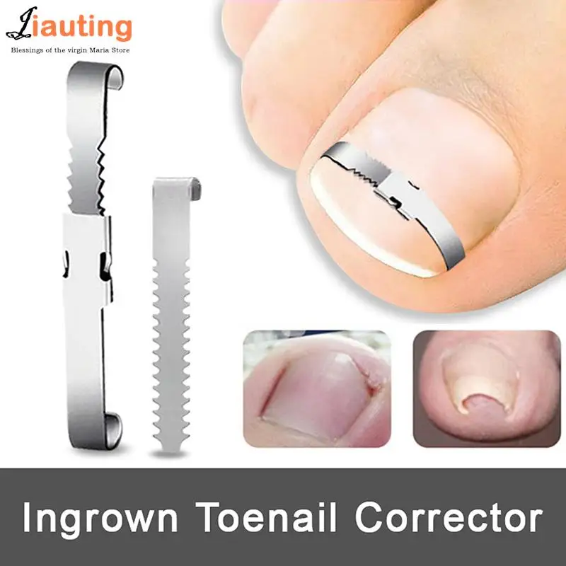 

Ingrown Toenail Corrector Tools Pedicure Recover Embed Toe Nail Treatment Professional Foot Care Correction Tool Care Foot