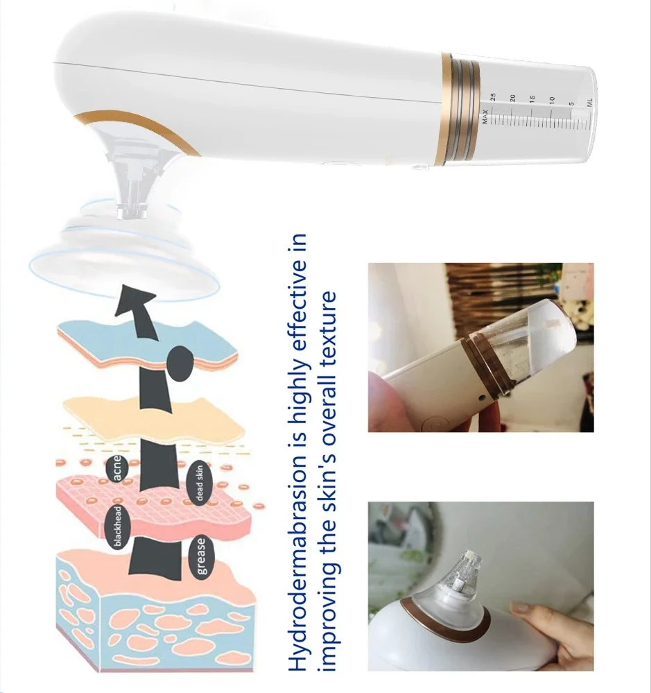 جهاز تنظيف بشرة احترافي