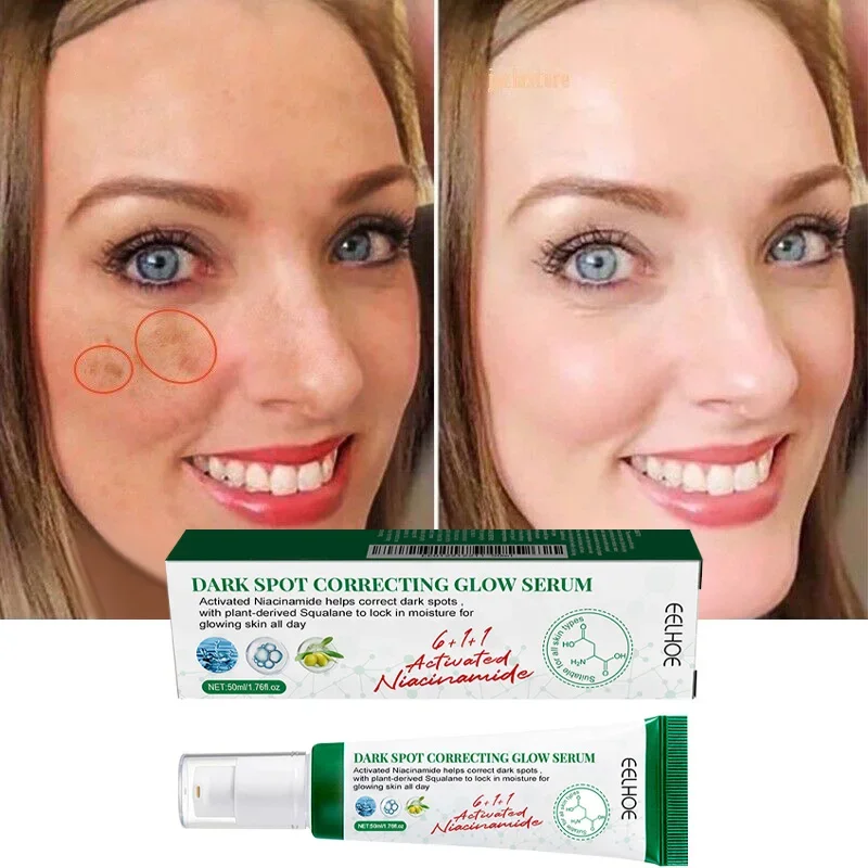 Facial Serum Dark Spot Correcting Glow Moisturizing Brightening Whitening Cream Reduce Freckles Dullness Acne And Melanin