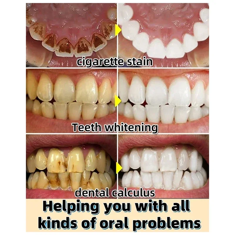 Whitening Toothpaste Dental Calculus Remover Mouth Odor Bad Breath Preventing Periodontitis Oral Care Product teeth whitening product teeth whitening essence dental calculus remover teeth health product