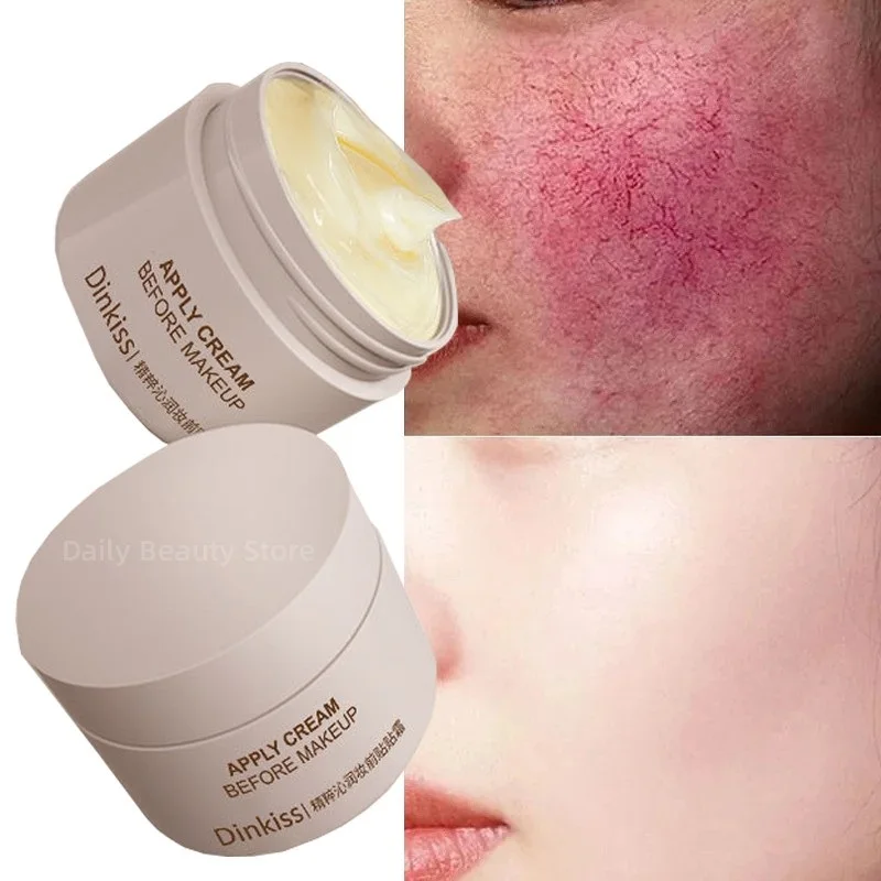 Facial Redness Repair Cream Improve Sensitive Skin Dryness Moisturizer Hydrating Sooth Lotion Removal Rosacea Korean Cosmetics