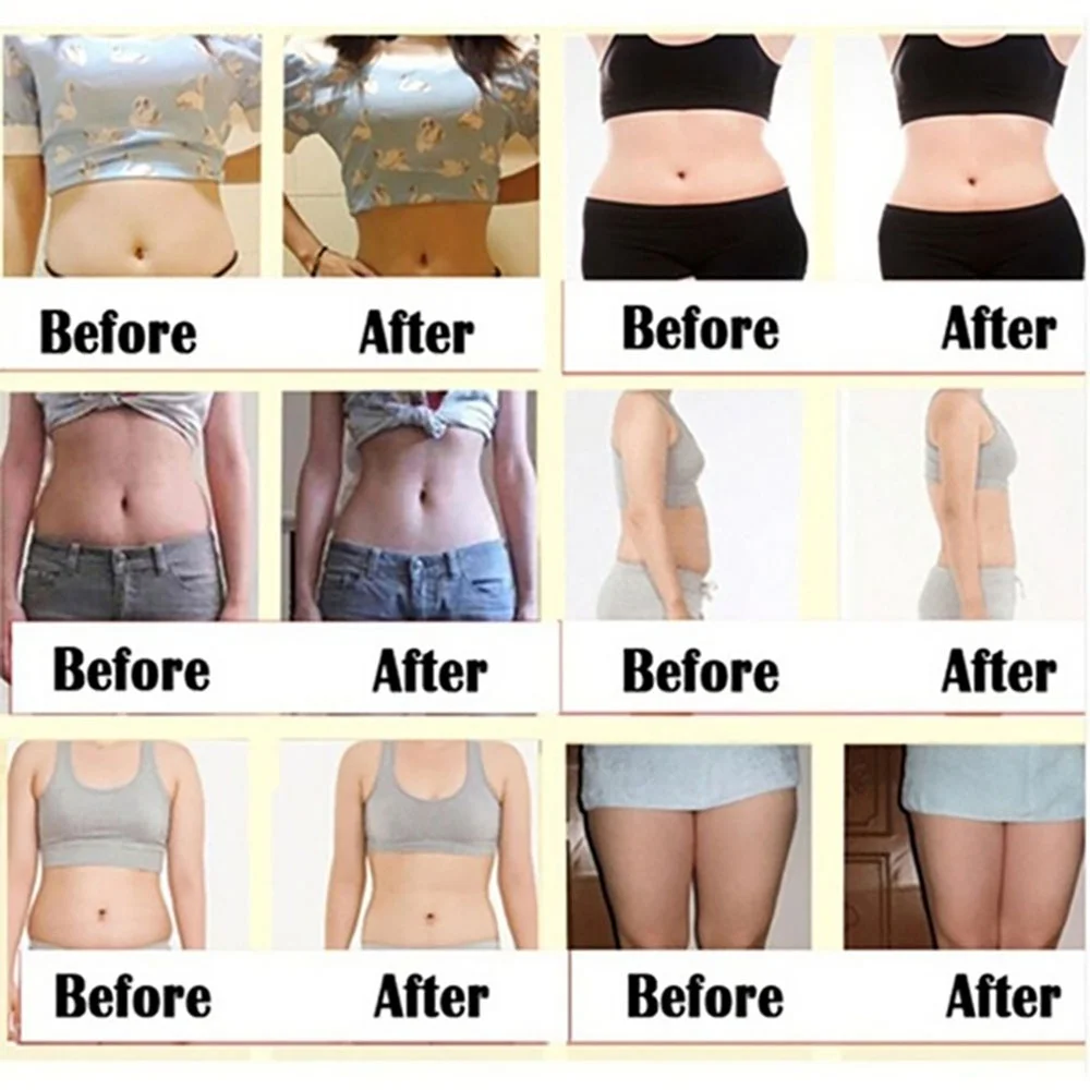 Chinese Medicine Slimming Patch Sticker Belly Button Paste Waist Belly Fat Burning Patch Skin Care Weight Los Products for Women