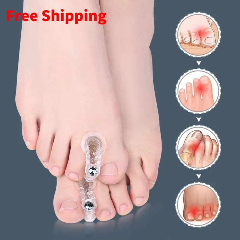 

1Pair Thumb Hallux Valgus Silicone Bunion Corrector Overlap Separators Toe Orthosis Clip Pads Big Foot Bone Care Tools Splitter