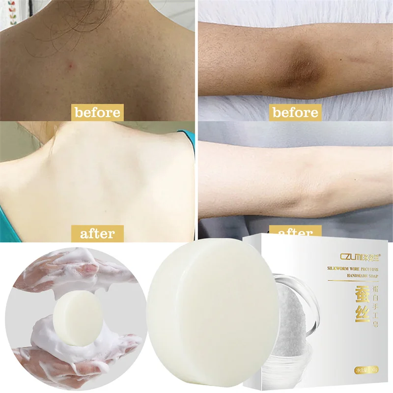 

Underarm Knee Bleaching Soap Body Whitening Soap Chicken Skin Removal Dark Spot Removal Dead Skin Moisturize Brighten Body Care