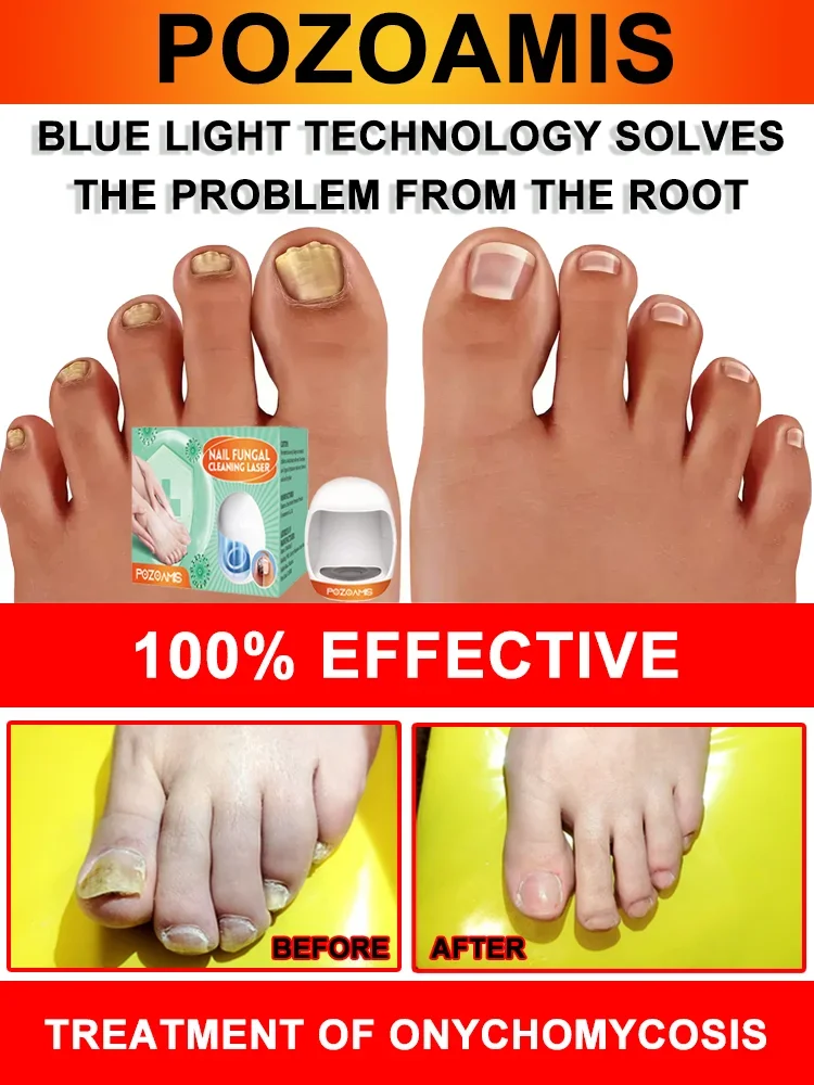 

Say goodbye to nail problems quickly and say "stay away from me" to nail discoloration and deformation