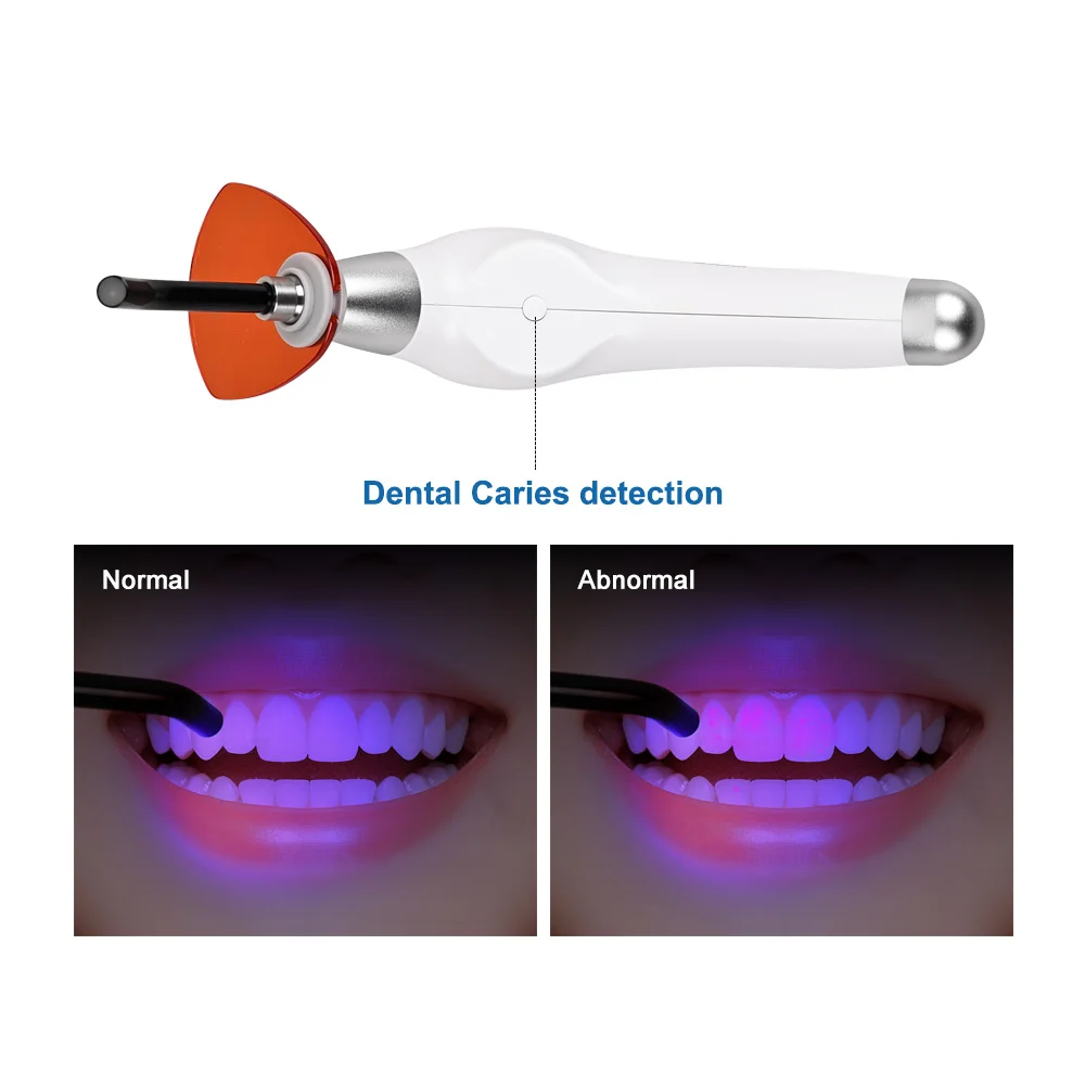 Lampe à Polymériser Dentaire LED Sans Fil 5W - Haute Puissance Pour Soins