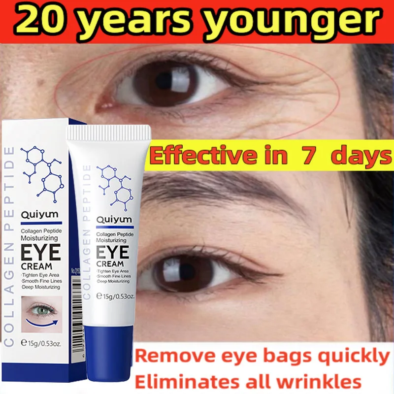 Collageen Rimpels verwijderen Oogcrème Vervagen Fijne lijntjes Lifting Stevige stimulator Crèmes Anti-donkere kringen Oogzakken Mois_voghion.com