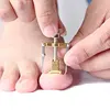 Correction of Paronychia with Toe Nail Correction Bracket for Treatment of Toe and Toe Care with Toe Fixator 3