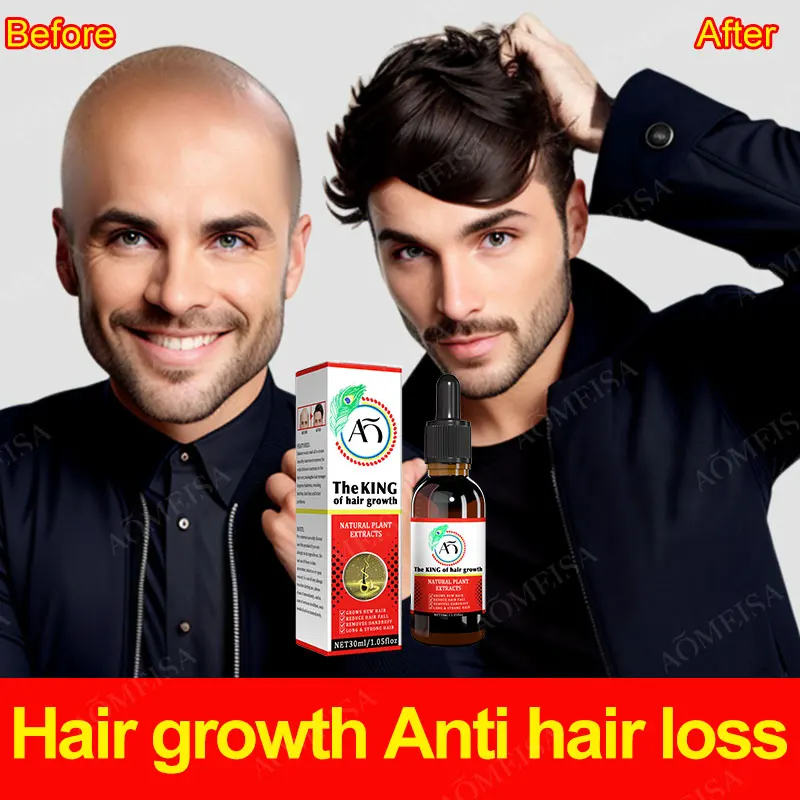 Fast Hair Growth Oil Hair Regrowth Serum Hair Thinning Treatment Hair