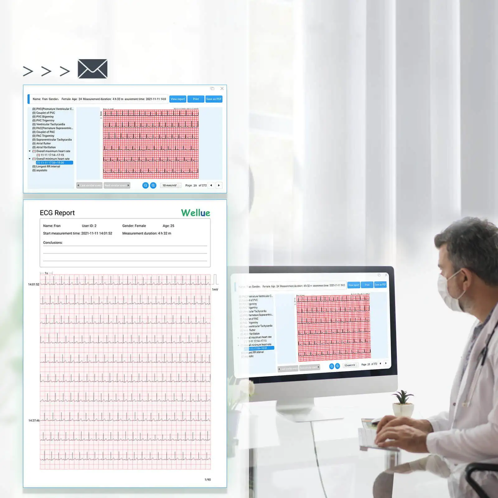 New AI Analysis ECG 24 Hours Monitoring Wearable ECG Bluetooth Heart Rate Monitoring Single Lead Usage Time 72 Hours