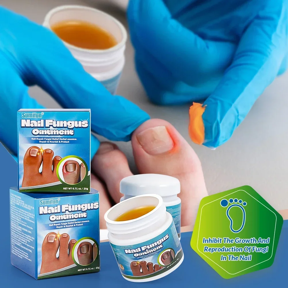 Nail Fungus Remover Treatment Cream Anti Infection Onychomycosis Paronychia Repair Gel Toe Nail Fungal Removal Hand Foot Care Products