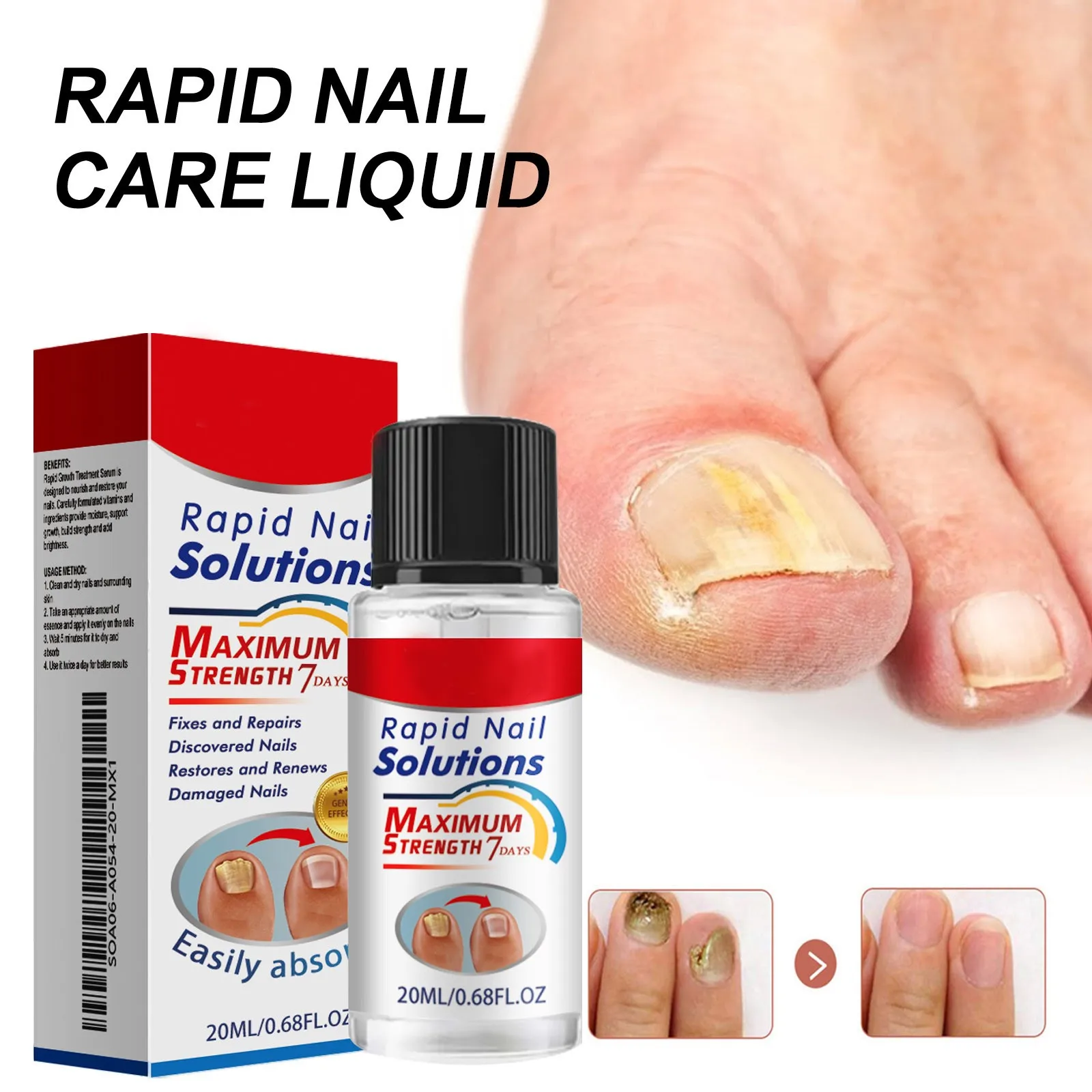 20ml Nail Repairing Liquid Fungus Treatment Essence skin care products,skin care essence,nail fungus repair device