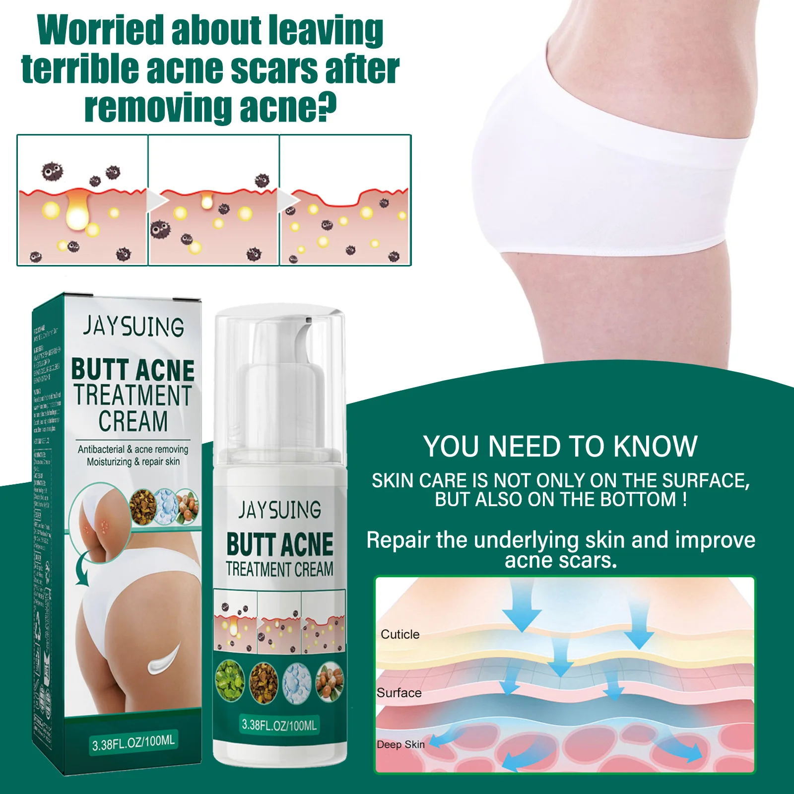 Butt Acne Treatmen Cream Buttock Pimple Removal Clearing Buttock Thigh Acne Moisturize Smoothing Nourish Body Acne Repair Cream 5