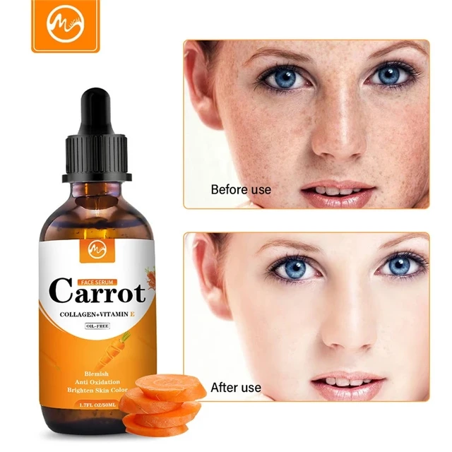 Minch 100Ml Sárgarépa Esszencia 99% E -Vitamin Kollagén Arc Szérum Emelő Simítás Fehérítés Távolítsa El A Pattanások Bőrápolási Termékeit - Image 3