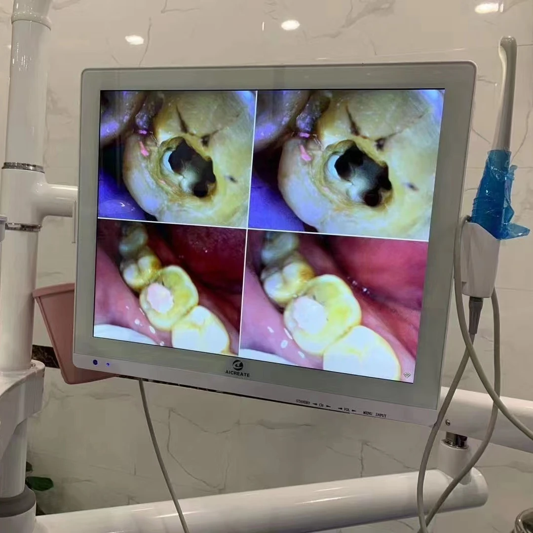

8.0 Mega Pixel intraoral den tal with 17 inch Resolution:1280*1024