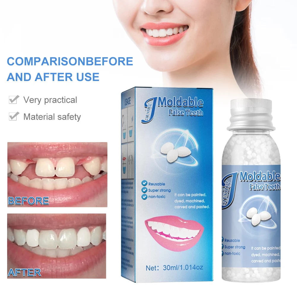

Sdotter 30g Resin False Teeth That Fit Solid Glue Temporary Tooth Repair Set Moldable Teeth And Gap False Teeth Glue Denture Too