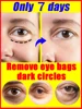 Remove bags Puffiness away work under eyes 1