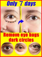 Remove bags Puffiness away work under eyes 1