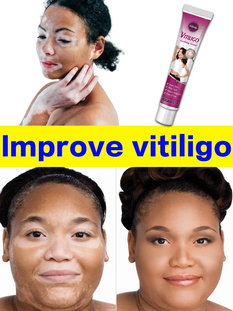 

Восстанавливающий Крем Vitiligo, мазь для ухода за кожей