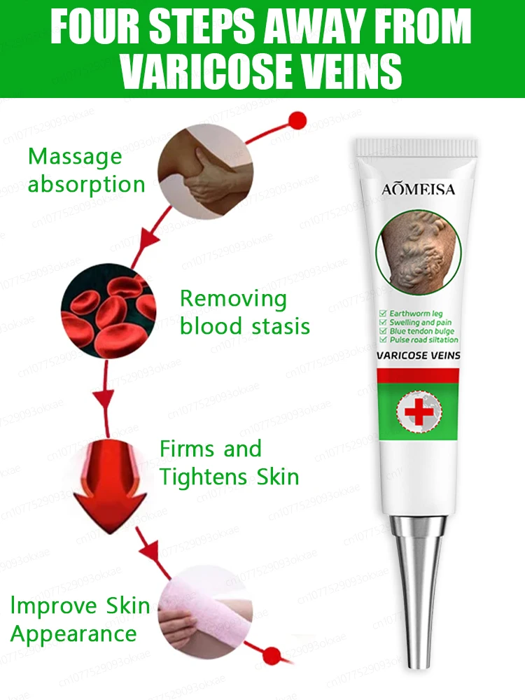 Effective Varicose Vein Relief Cream Ointment For Varicose Veins To Relieve Vasculitis Phlebitis