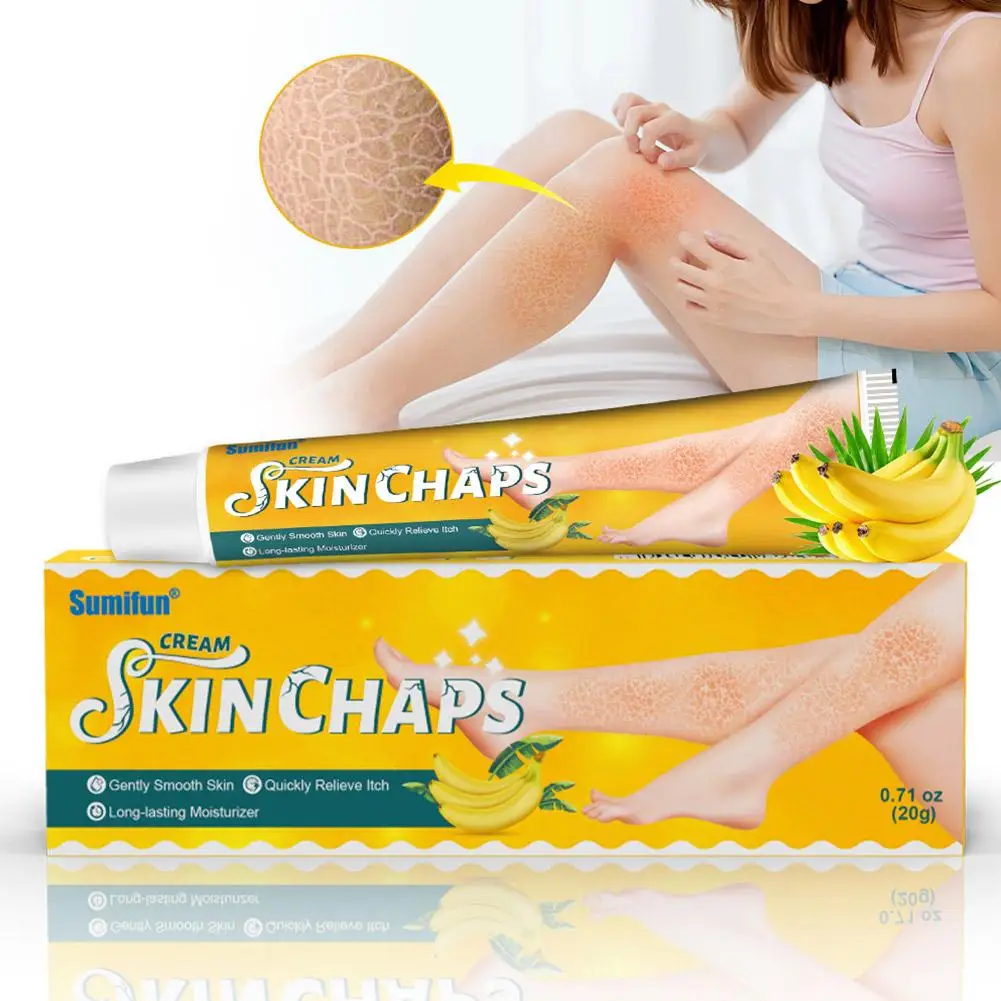 

Removal Chicken Skin Cream Repair Dry Exfoliation Peeling Snake Fish Cream Skin Care Moisturizing Scale Smooth Whitening Sk R0W3