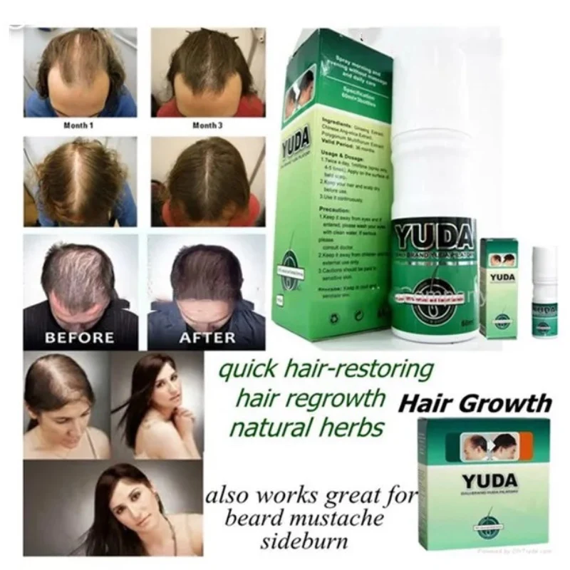 Bald head treatment YUDA and FEG hair regrowth new hair loss treatments ANTI HAIR LOSS SPRAY kit