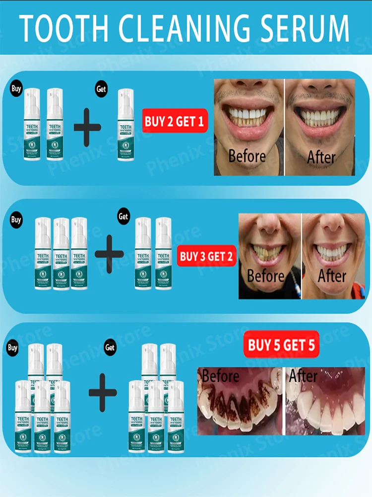 Teeth Whitening Mousse Dental Care Essence Remove Plaque Tooth Stain Gingival Repair Caries Prevention Oral Cleaning 30ml