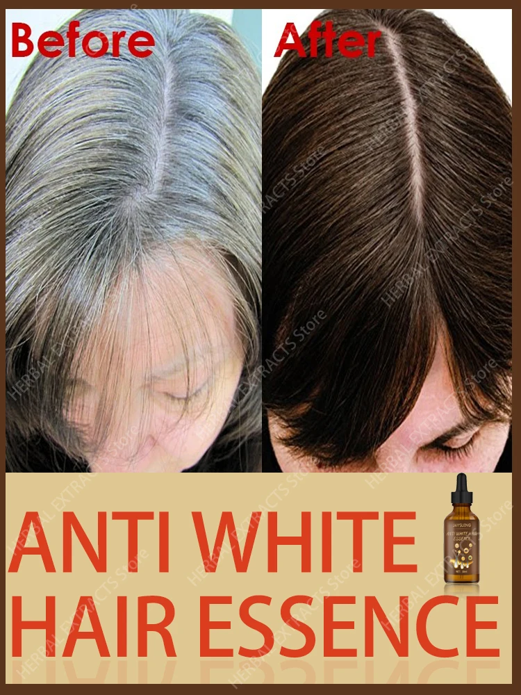 Gray Hair Treatment Serum White to Black Natural Color Repair Nourishing Products