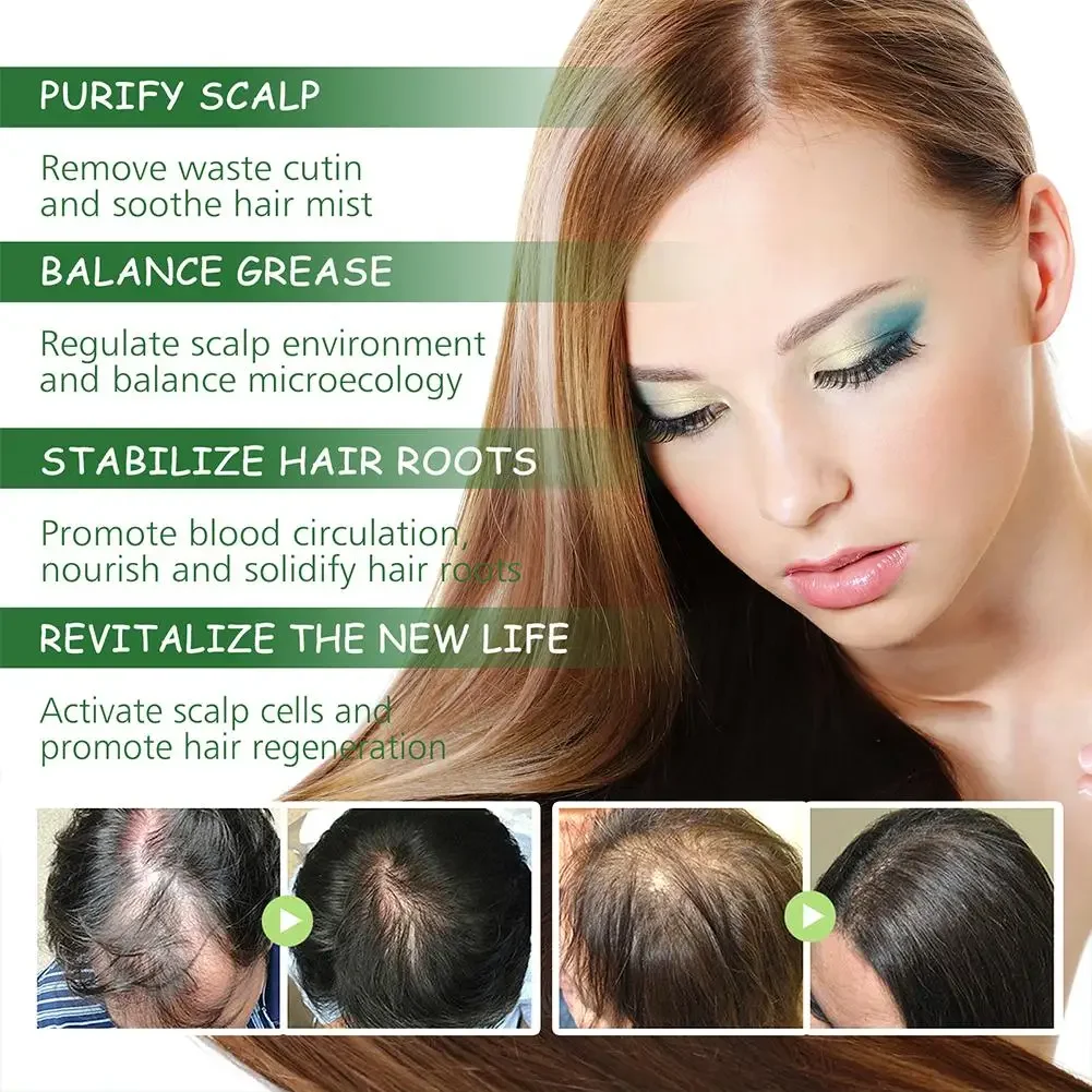 Rosemary Hair Care Essential Oil Nourishes Hair Roots Repairing Dense Solid 30/50/60ml Improvement Bifurcation hair treatment oil