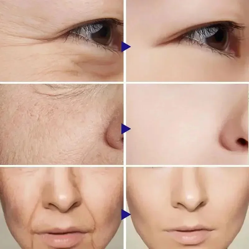 Retinol Facial Serum for Wrinkle Removal and Anti Aging