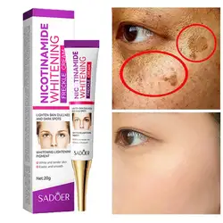 Removal Melasma Remover Moisturize Brighten Face Whitening Freckles Cream Remove Melasma Dark Spot Lightening Melanin Skin Care