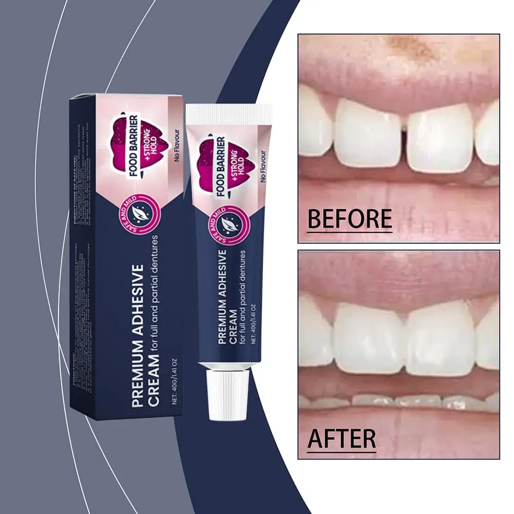 Fixodent Dental Adhesive Cream For Denture Original Strong Complete Professional Dentures Glue Dentistry Products Mater G9z9 40g