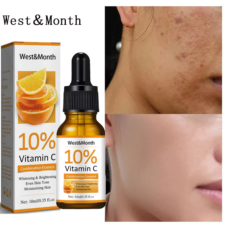 Vitamin C Whitening Freckle Removal Serum Fade Dark Spots Melanin