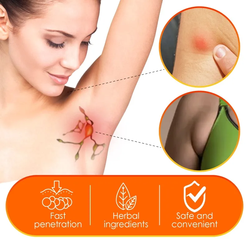Herbal Lymphatic Detox Cream Breast Armpit Anti-Swelling Node Ointment Treatment Chest Medical Ointment Lymph Care Cream