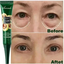 Remove Wrinkles Eye Cream Anti Dark Circles Bags Puffiness Fade Eye Fine Line Tighten Whiten Under Eyes Skin Good Care Product