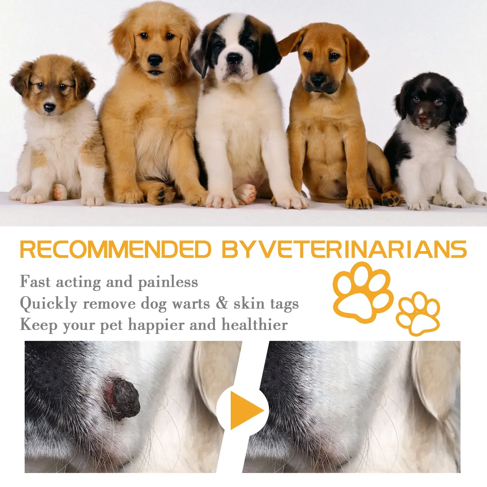 Wart Remover Cream 3