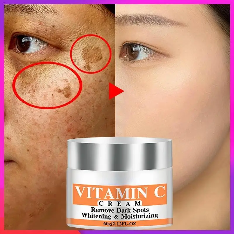 

Newest Vitamin C Whitening Facial Cream Repair Fade Freckles Remove Dark Spots Melanin Remover Brightening Face Cream