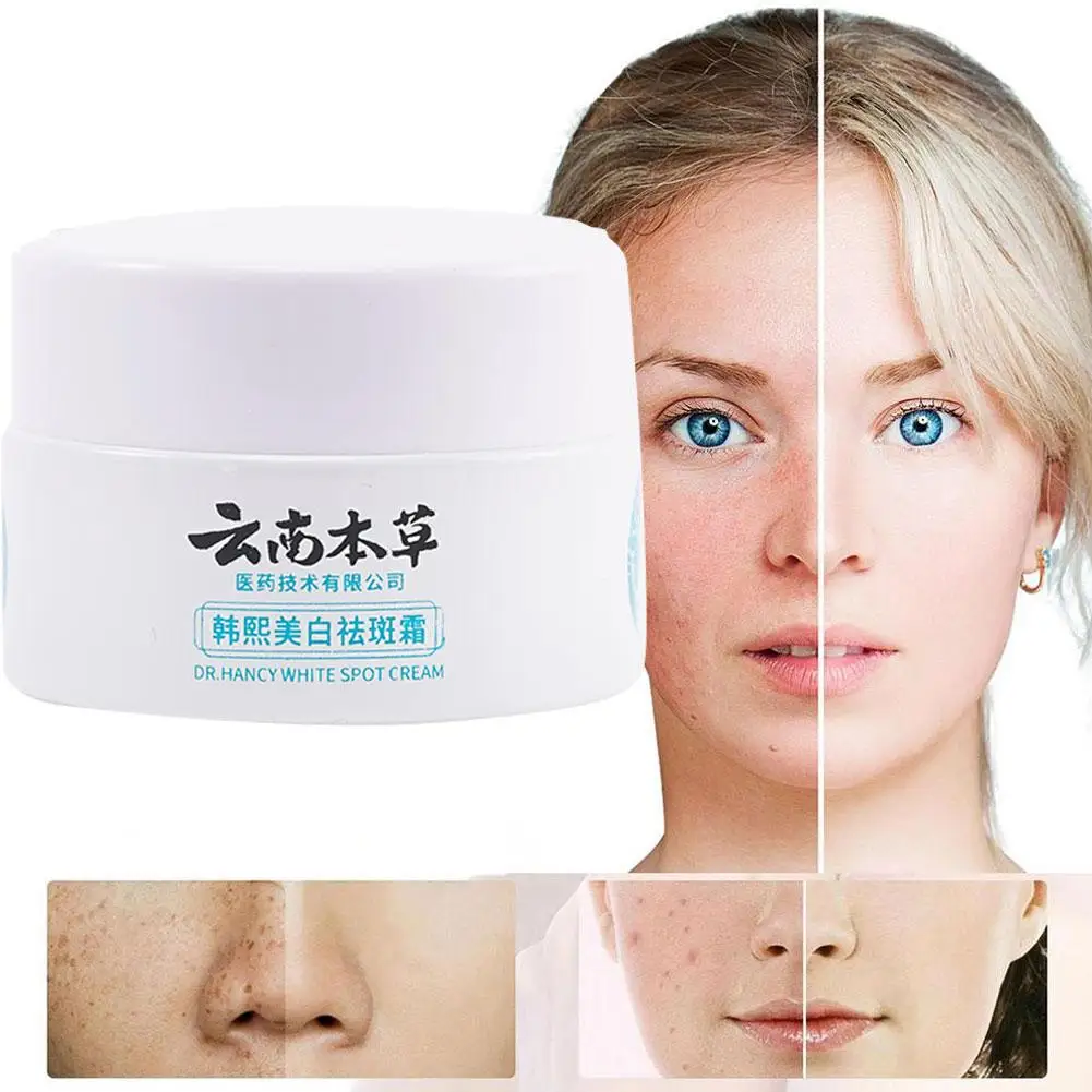 

20g Powerful Yunnan Herb Whitening Freckle Cream Remove Acne Spots Dark Spots Face Moisturizing Face Skin Care Beauty