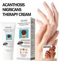 Brighten Cream Bleaching Armpits Elbows Knees Moisturizing Body Lotion Cream Brightening Lightening Melanin Skin Cream 1