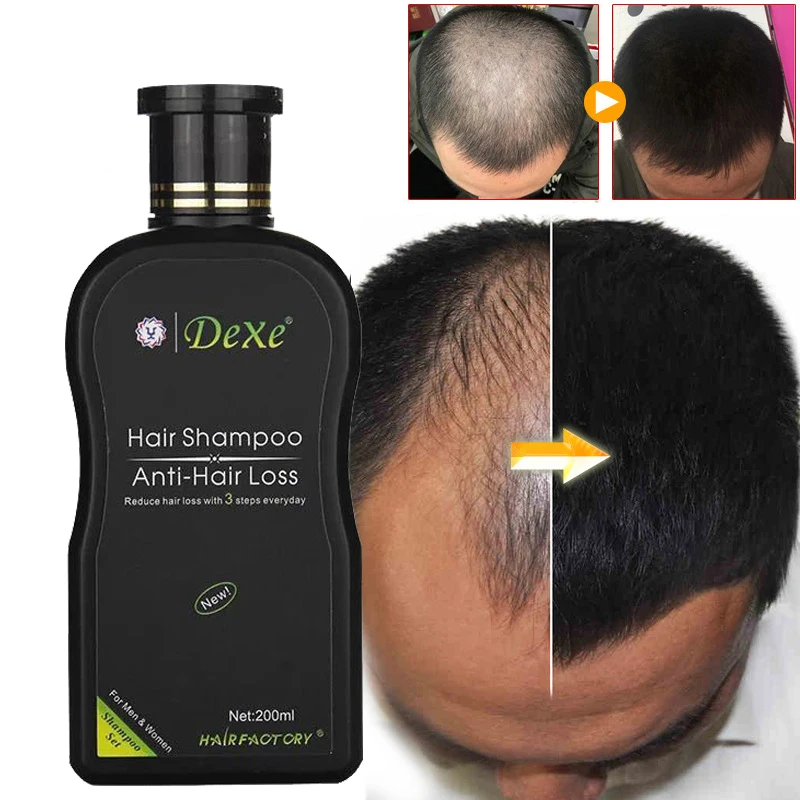 

Dexe Professional Hair Growth Shampoo Anti-hair Loss Chinese Herbal Hair Growth Product Prevent Hair for Men & Women