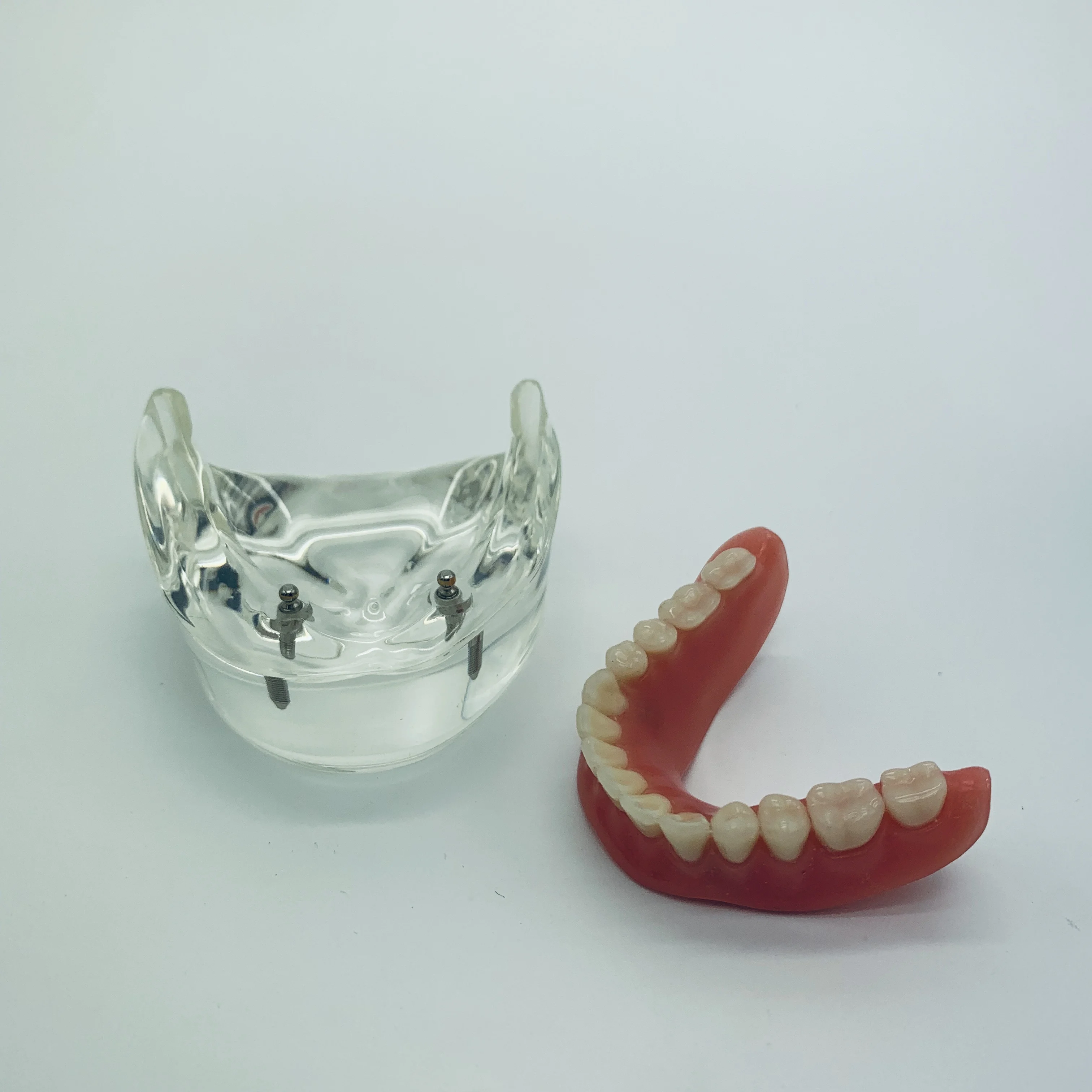 

Clinic Decoration Dental Overdenture Interior Mandibular Lower with 2 Implant Restoration Teeth Study Teach Model