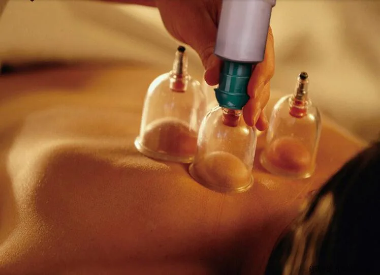 32 pieces of Chinese vacuum cupping therapy relaxation massager