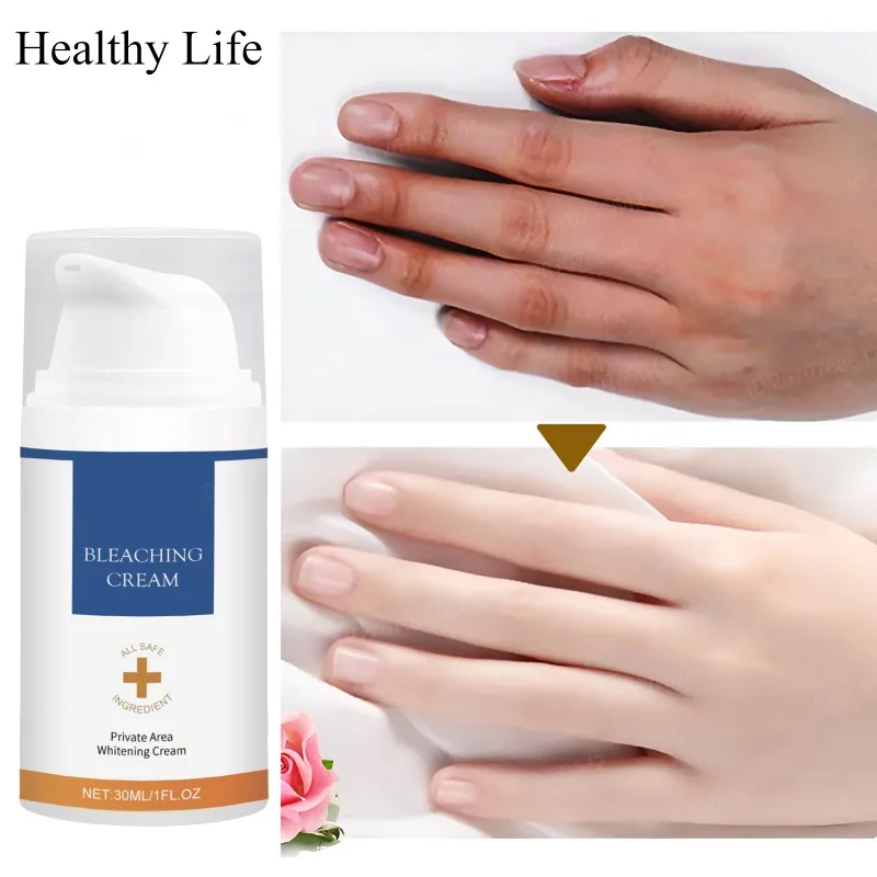 Whitening Knuckles Cream Underarm Elbow Moisturize Brighten Cream Women Intimate Areas Whiten Lotion Fade Melanin Body Skin Care gluta master kojic acid oil whitening relaxing essential oil for body and intimate areas to reduce dark spots and melanin