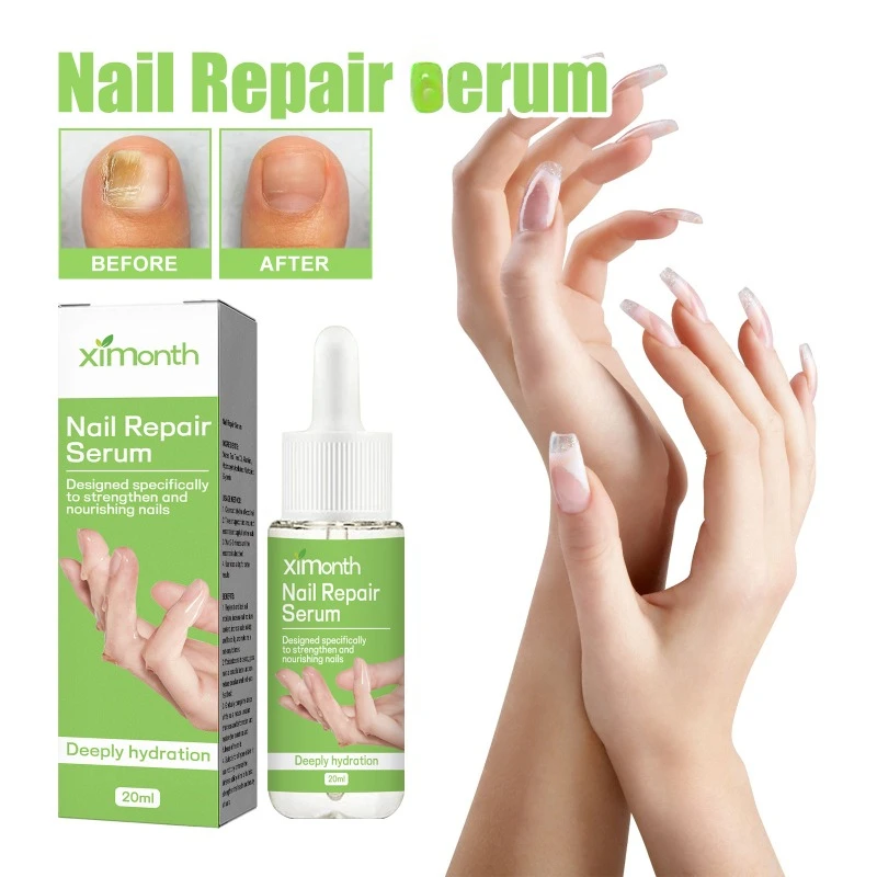 

Nail Fungus Treatment Serum Hand Foot Care Removal soft nails Thickening toe nails Anti-infective Onychomycosis repair Essence
